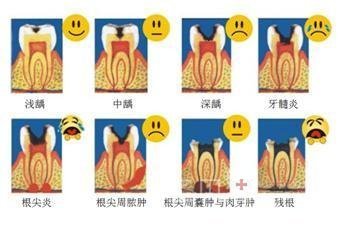 關(guān)于蛀牙你知道多少